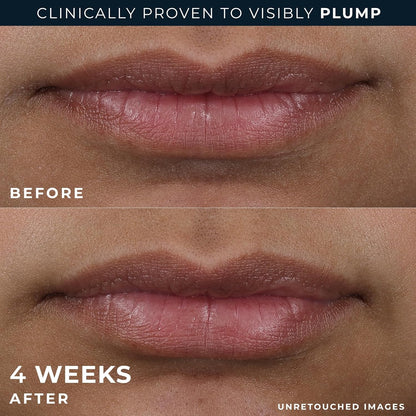 Premium Lip Plumper