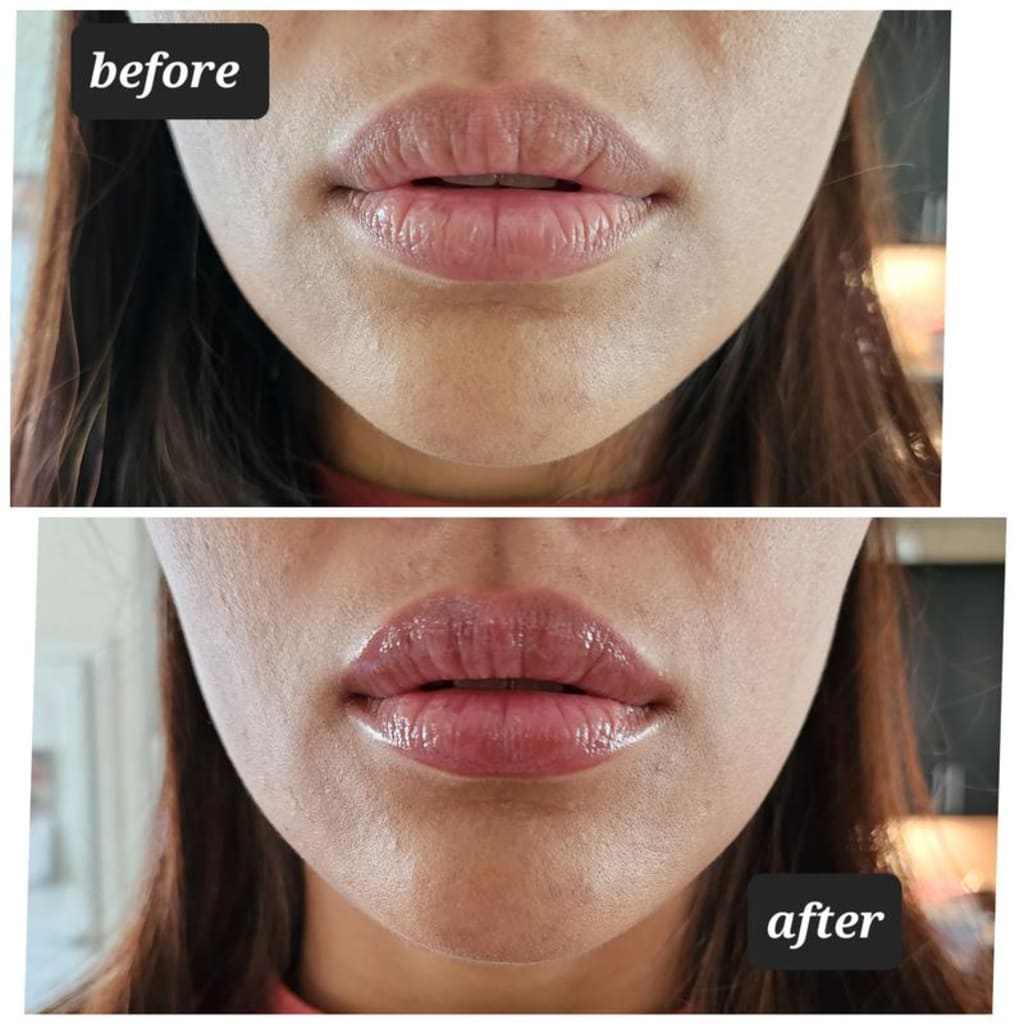 Instant Lip Volumizer Pen