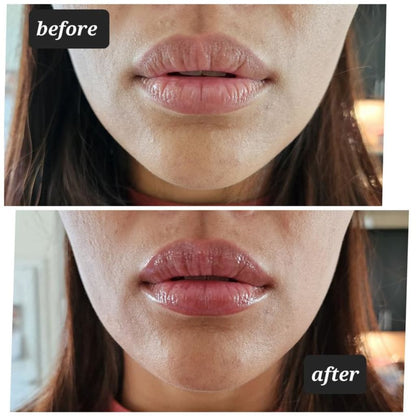 Instant Lip Volumizer Pen